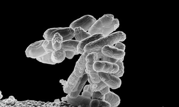E-coli-bacteria